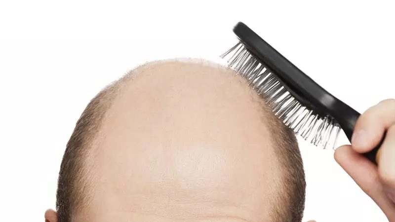 Foto: 10 Dicas para Evitar a Queda de Cabelo