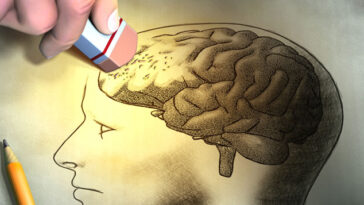 Alzheimer: Como a doença que afeta as funções cognitivas